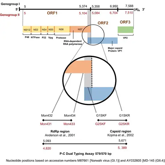 Neuroviruses Panel Qualitative PCR